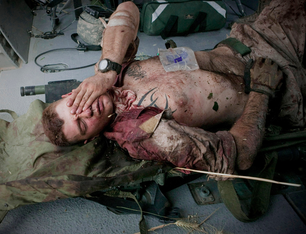 FILE - Injured U.S. Marine Cpl. Burness Britt reacts after being lifted onto a medical evacuation helicopter from the U.S. Army's Task Force Lift "Dust Off," Charlie Company 1-214 Aviation Regiment, June 4, 2011. Britt was wounded in an IED strike near Sangin, in the Helmand Province of southern Afghanistan. (AP Photo/Anja Niedringhaus, File)