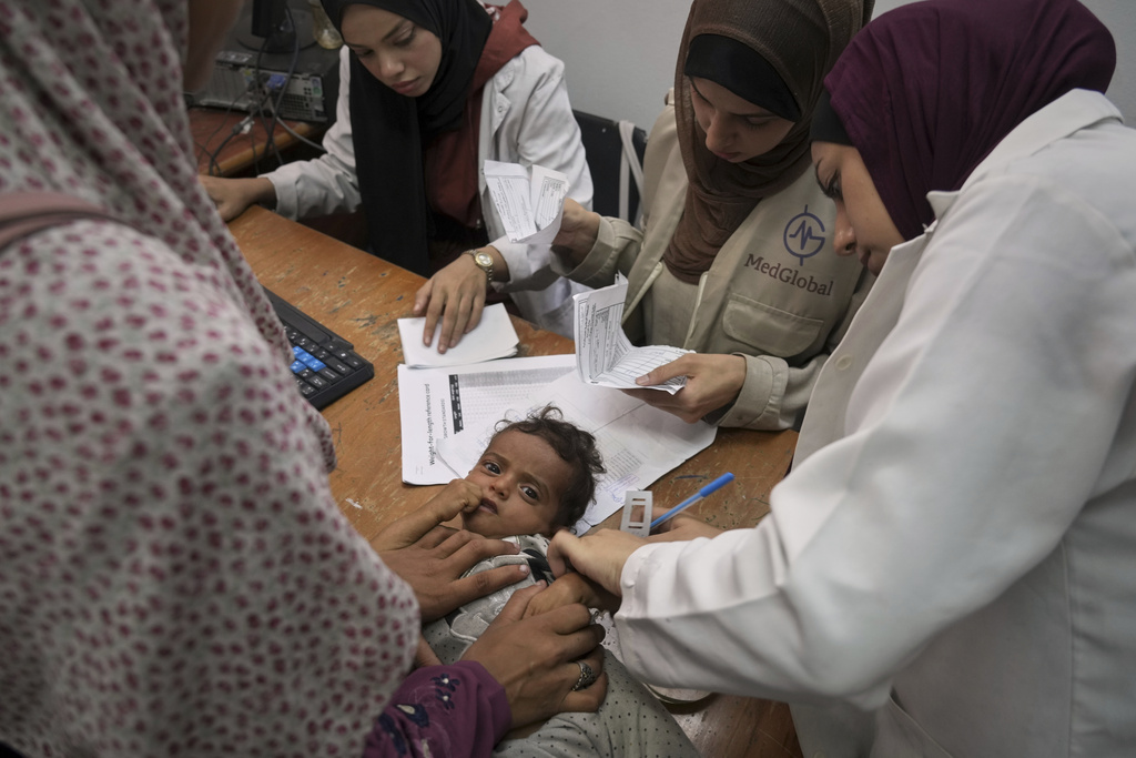 A doctor measures a child's arm to check for signs of malnutrition at the Al-Ahli Arab Hospital Gaza City in Gaza on July 23, 2025. (AP Photo/Jehad Alshrafi)