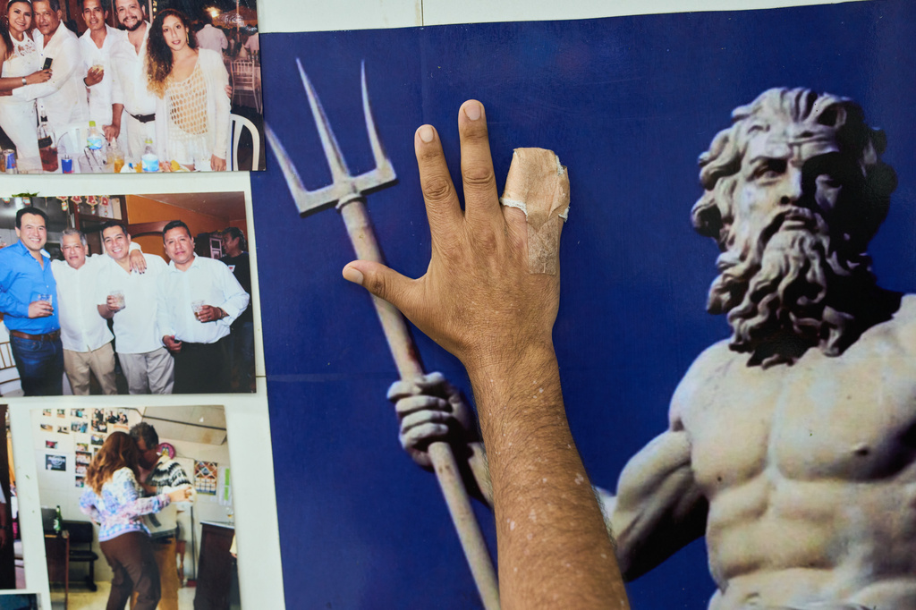 Ivan Diaz, a money lender, shows his hand with fingers he says were amputated by kidnappers who abducted him and later released him after a ransom was paid, in Trujillo, Peru, Thursday, May 21, 2026. (AP Photo/Rodrigo Abd)