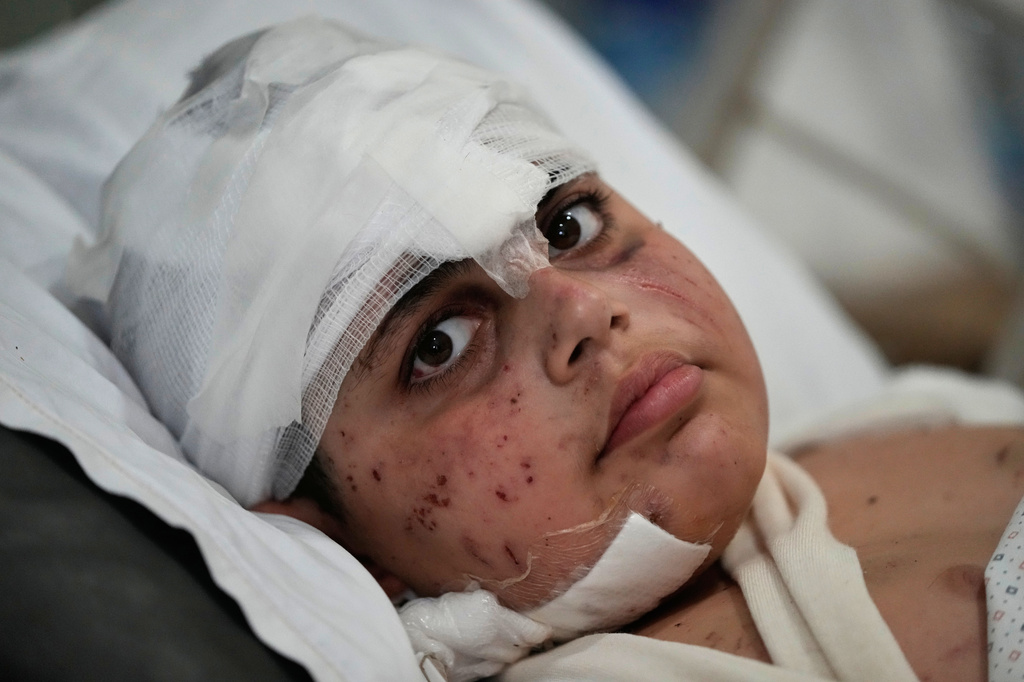 Ali Salman, 12, who was injured in an Israeli airstrike, lies on a bed at Jabal Amel hospital in the southern port city of Tyre, Lebanon, Tuesday, May 26, 2026. (AP Photo/Mohammed Zaatari)