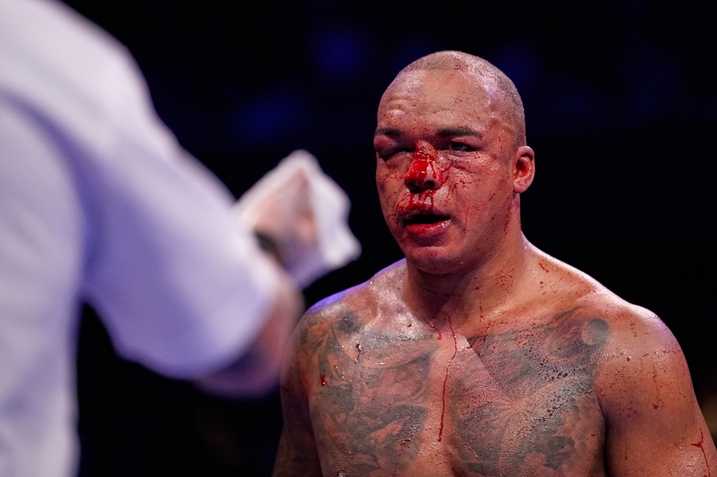 Britain's Fabio Wardley walks back to his corner bloodied by Britain's Daniel Dubois during their WBO World Heavyweight boxing title bout in Manchester, Saturday, May 9, 2026. (AP Photo/Dave Thompson)