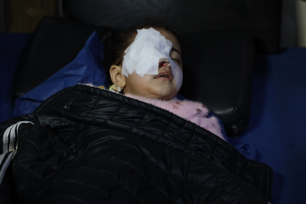 Syrian child Fatima al-Zahra Abu Sheikh, 4, lies in a hospital bed after being wounded when clashes broke out between Syrian government forces and Kurdish fighters in a contested area of the northern city of Aleppo, Syria, Tuesday, Jan. 6, 2026. (AP Photo/Omar Albam)