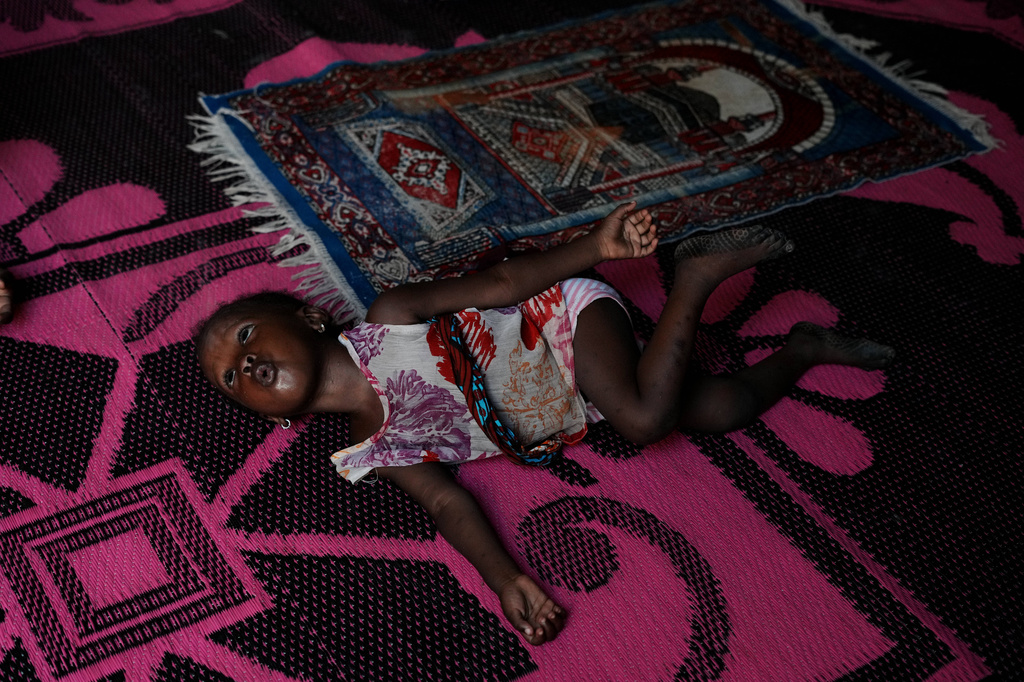 Farisa, who has relapsed into malnutrition, plays on a mat inside her house in Kware Sokoto, northwestern Nigeria, Wednesday, July 15, 2026. (AP Photo/Sunday Alamba)