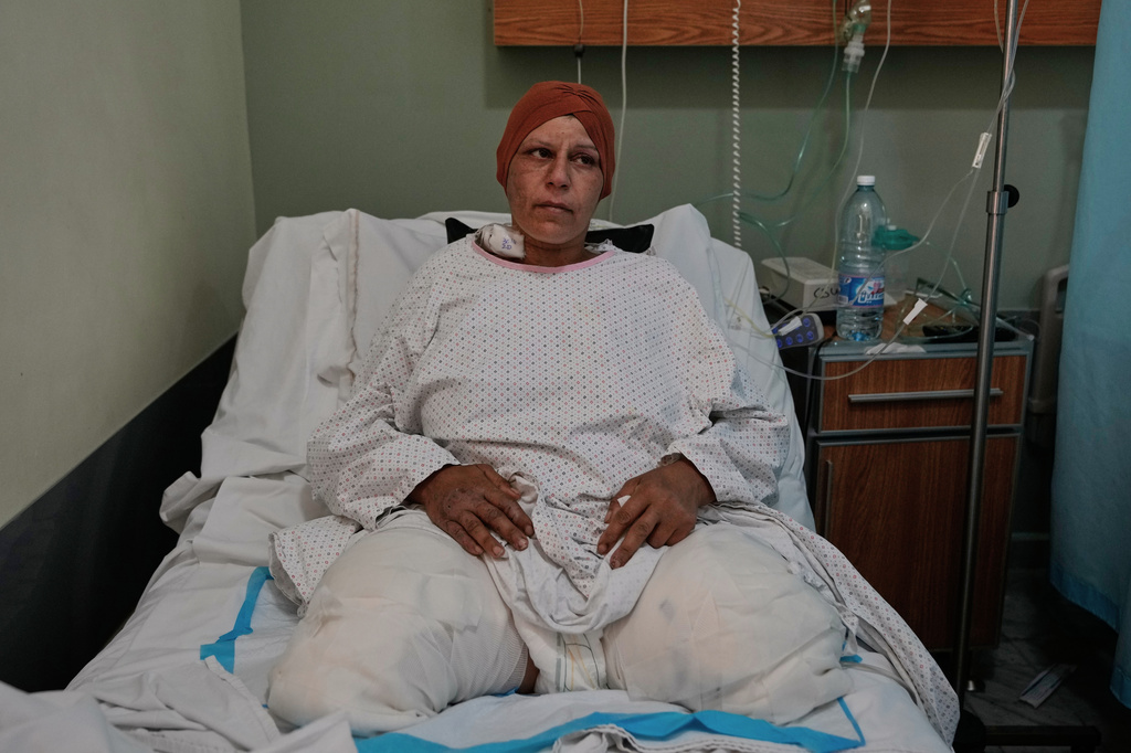 Sanaa Khalil, 35, a Syrian farmer who lost her two legs in the past days by an Israeli strike while she was working at a banana plantation, lies on a bed at a hospital in the southern port city of Tyre, Lebanon, Friday, May 1, 2026. (AP Photo/Hussein Malla)