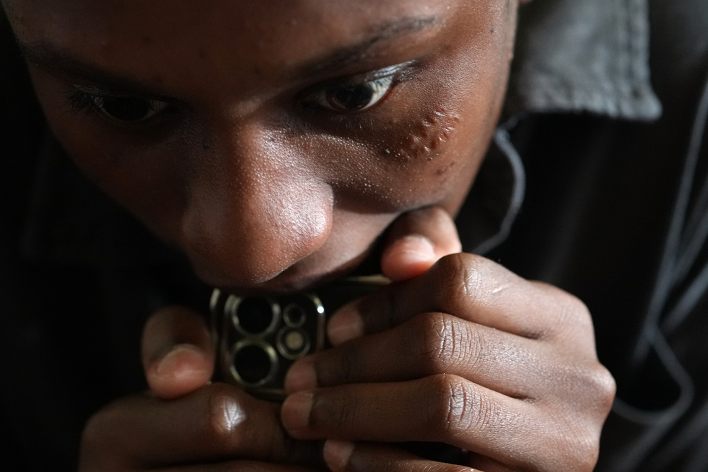 Detamisse Janvier, 20, reacts as she talks about the circumstances that led her to flee Haiti and seek asylum in the U.S., in Orlando, Fla., Friday, Aug. 22, 2025. Janvier's face still bears a scar from being injured while running desperately to escape an attack by an armed gang on her home in Port-au-Prince. (AP Photo/Rebecca Blackwell)