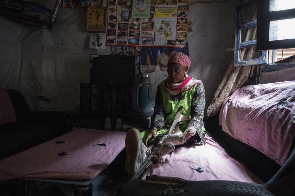 Melissa Amuli, one of many wounded by fighting in the region, sits in her home in Goma, eastern Congo, Friday, Aug. 29, 2025. (AP Photo/Moses Sawasawa)