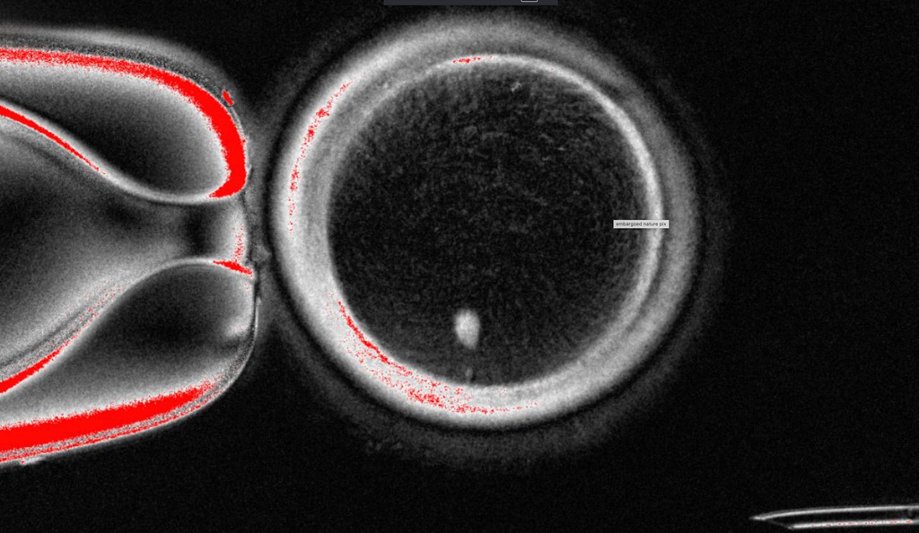 This undated image provided by the Mitalipov Laboratory at Oregon Health & Science University shows a a microscope image of a human egg that contains a nucleus taken from a skin cell. (Mitalipov Laboratory via AP)