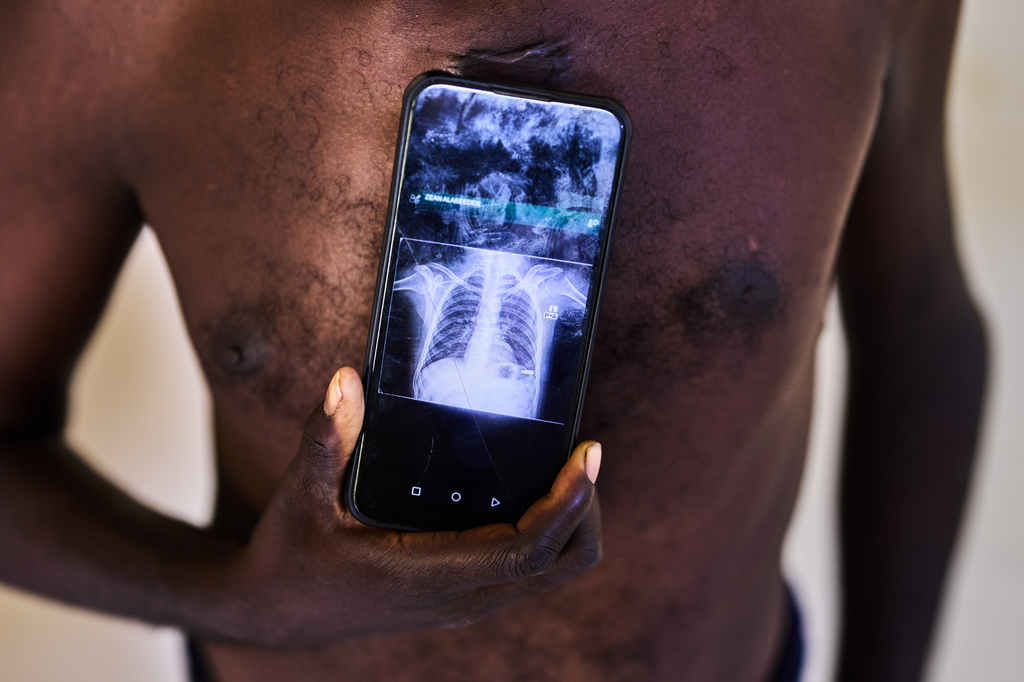 A man shows an X-ray revealing a bullet lodged in his chest during a visit at Al Nao Hospital in Omdurman, on the outskirts of Khartoum, Sudan, Saturday, April 18, 2026. (AP Photo/Bernat Armangue)