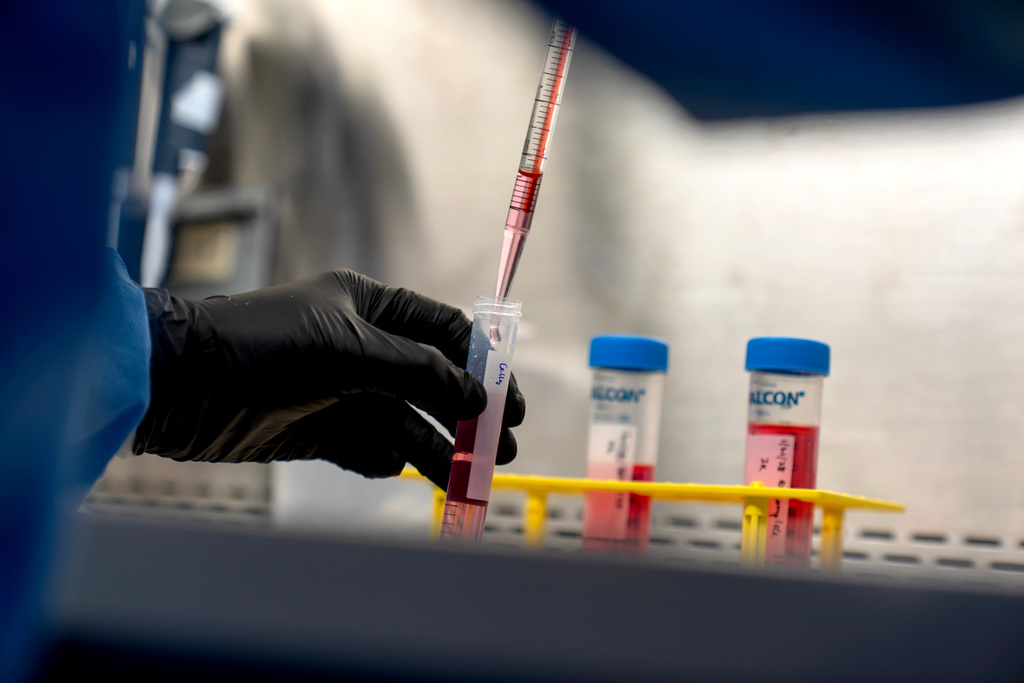 Dr. Justin Kwong, a research fellow who coaxes human stem cells to grow into a kind of immune cell involved in autoimmune diseases, works in a lab at the National Institutes of Health, Tuesday, Jan 21, 2025, in Bethesda, Md. (AP Photo/David Goldman)
