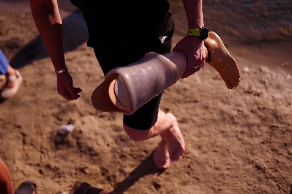 A friend holds the prosthetic leg of a Ukrainian war veteran during a sporting event to encourage people and injured soldiers to take part in sports at a lake on the outskirts of Kyiv, Monday, Aug. 24, 2026, during the 35th anniversary of Ukraine's Independence Day. (AP Photo/Francisco Seco)