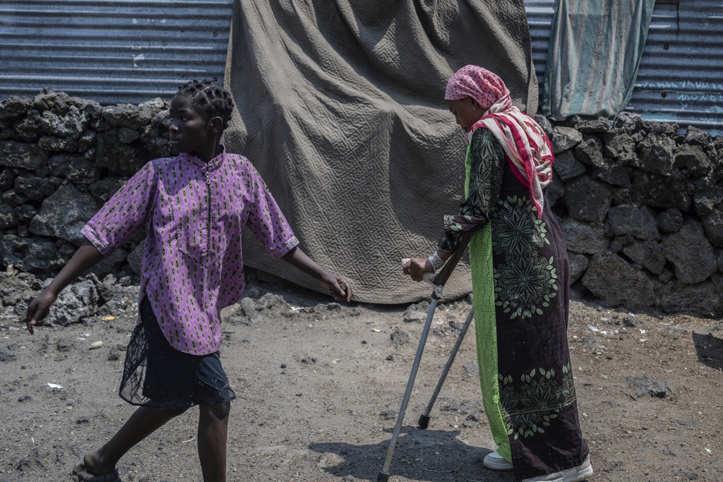 Melissa Amuli, one of many wounded by fighting in the region, walks in her neighborhood to exercise in Goma, eastern Congo, Friday, Aug. 29, 2025. (AP Photo/Moses Sawasawa)