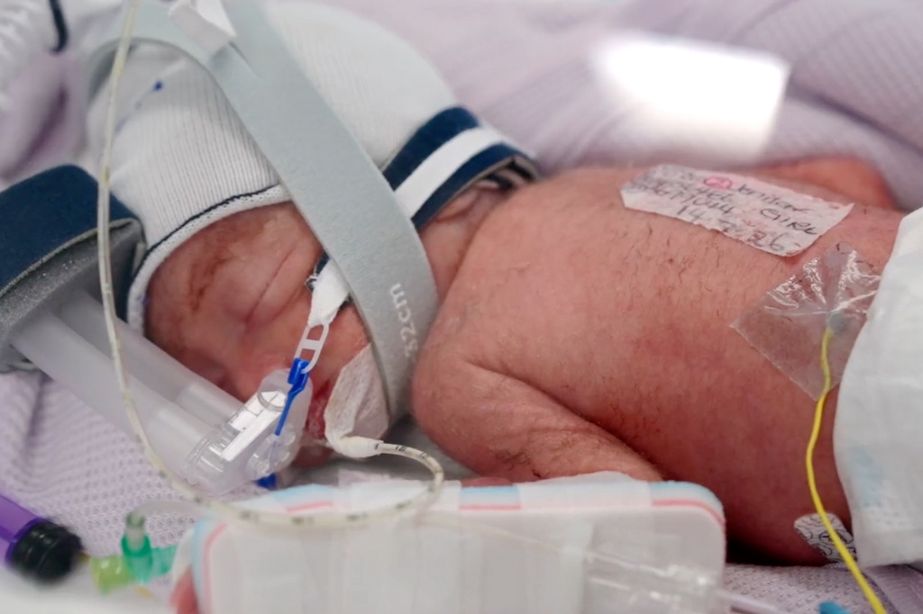 In this image taken from video taken on July 15, 2026, one of the quadruplets born at Metro North Health hospital lies in an incubator in Brisbane, Australia. (Metro North Health via AP)