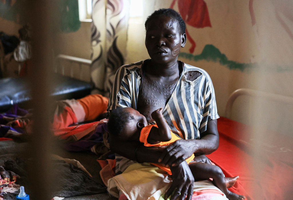 A mother sits with her child in the malnutrition ward of Bunj Hospital in Maban, South Sudan, Tuesday, Aug. 19, 2025. (AP Photo/Caitlin Kelly)