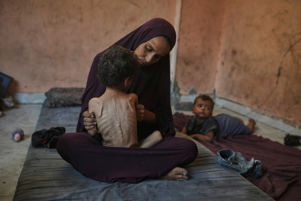 Naima Abu Ful sits for a photo with her 2-year-old malnourished child, Yazan, at their home in the Shati refugee camp in Gaza City, Wednesday, July 23, 2025. (AP Photo/Jehad Alshrafi)