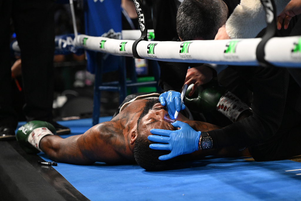 Trainers check on Joe George Jr. after he collapsed in his corner after the first round of his light heavyweight boxing match against Atif Oberlton, Sunday, Feb. 22, 2026, in Detroit. (AP Photo/Lon Horwedel)