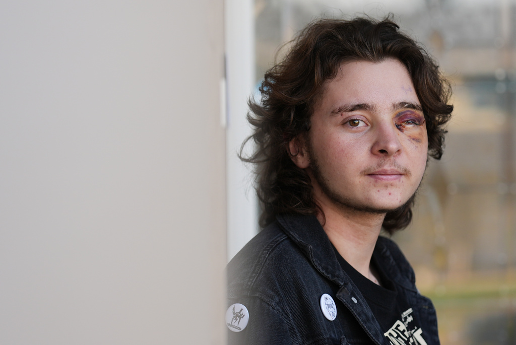 Kaden Rummler, who was injured after being hit with a projectile fired by a federal agent during a protest outside an immigration building in Santa Ana, Calif., poses for a portrait Wednesday, Jan. 14, 2026, in Southern California. (AP Photo/Damian Dovarganes)