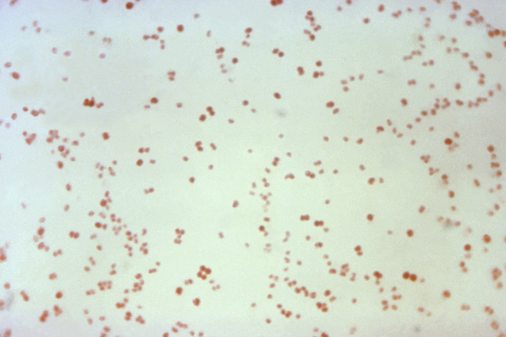 FILE - This 1971 microscope photo provided by the Centers for Disease Control and Prevention shows Neisseria gonorrhoeae bacteria, which causes the sexually-transmitted disease gonorrhea. (CDC via AP, File)