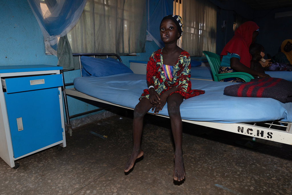 Hajira Sahabi, who underwent facial reconstructive surgery to help her recover from noma disease, poses at the Noma Children Hospital in Sokoto, northwest Nigeria, Thursday, Sept. 3, 2026. (AP Photo/Ifeanyi Emmanuel)
