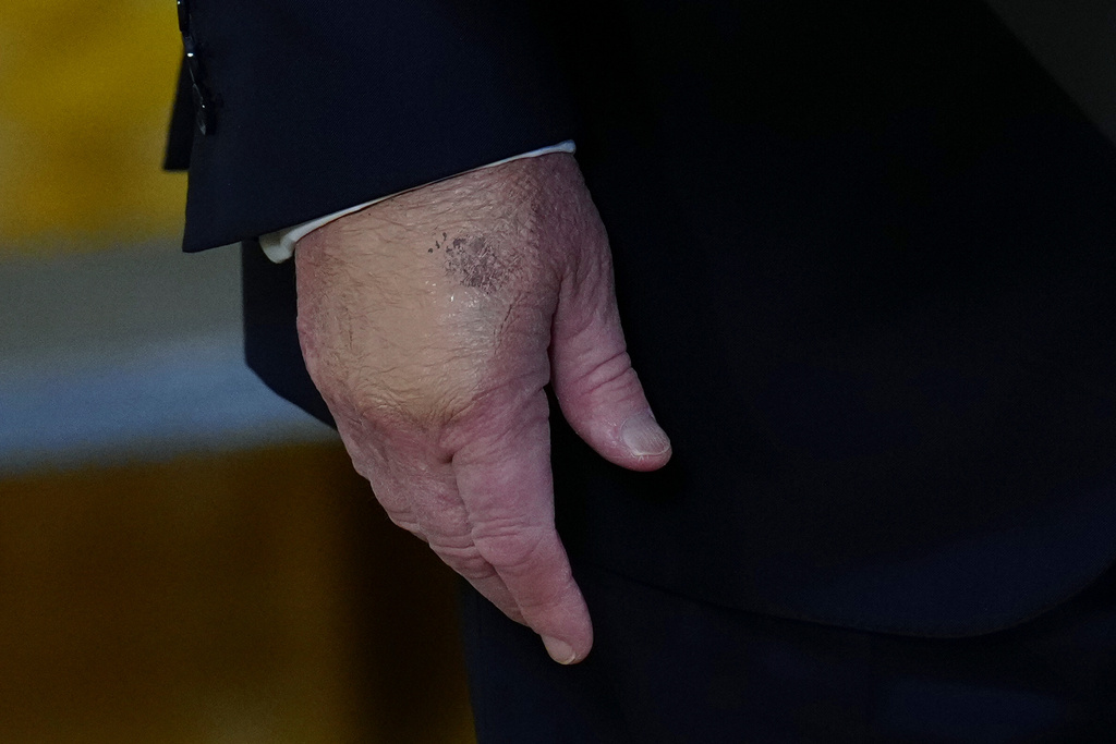 President Donald Trump's right hand is seen during a Mother's Day event for members of the military, Wednesday, May 6, 2026, in the East Room of the White House, in Washington. (AP Photo/Jacquelyn Martin)