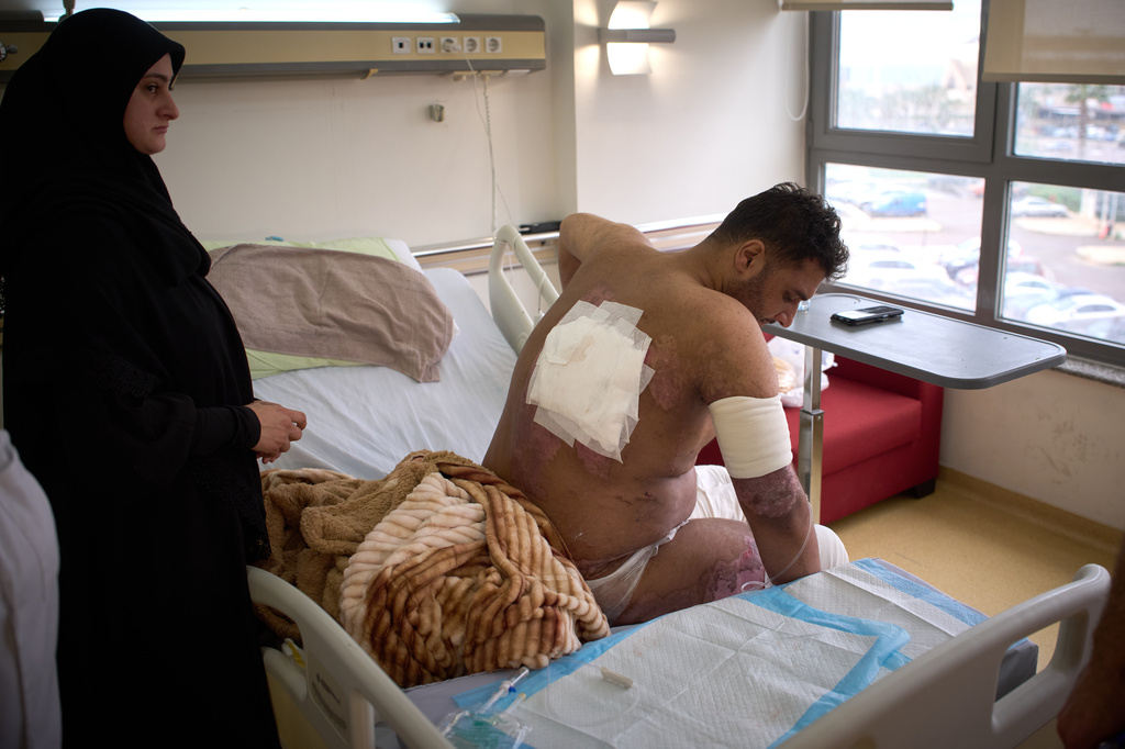 A man with burn wounds from an Israeli airstrike on southern Lebanon sits on a bed at the Sidon Government Hospital in Sidon, Lebanon, Thursday, April 2, 2026. (AP Photo/Emilio Morenatti)