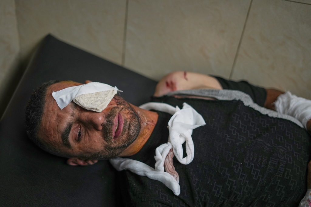 A man injured in a blast that Syrian state media said was caused by an explosive device planted in a minivan taxi in the Jaramana suburb, waits to be treated at Al-Mujtahid Hospital in Damascus, Syria, Thursday, Aug. 6, 2026. (AP Photo/Omar Albam)
