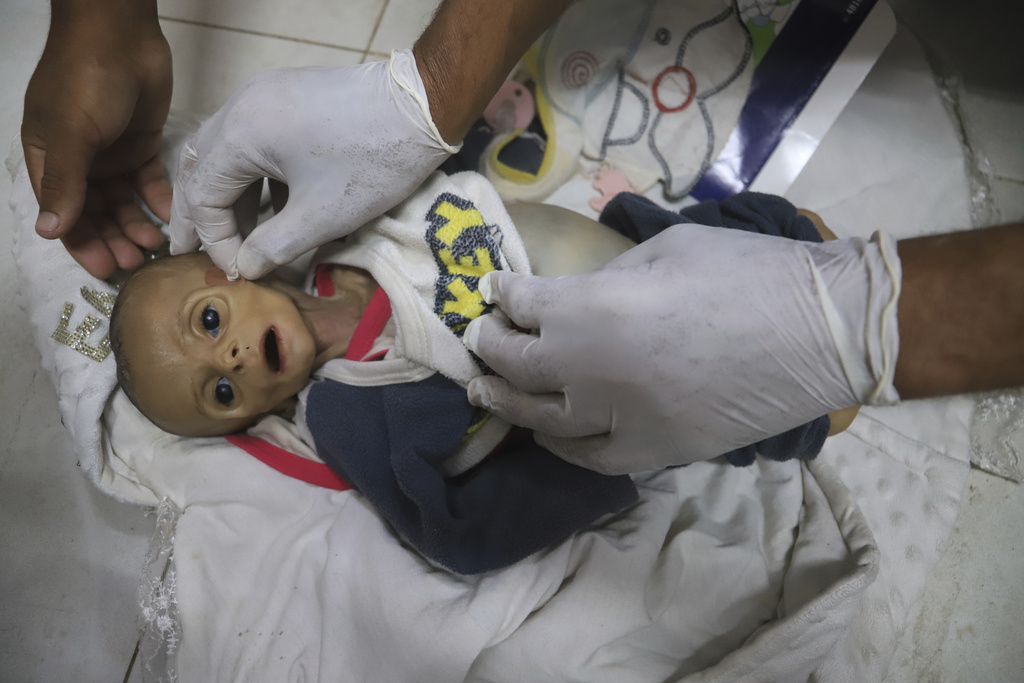 EDS NOTE: GRAPHIC CONTENT - A morgue worker prepares the body of 5-month-old baby, Zainab Abu Halib, who died from malnutrition-related causes, according to Dr. Ahmed al-Farah, head of the pediatric department at Nasser Hospital, before her funeral in Khan Younis, Gaza Strip, July 26, 2025. (AP Photo/Mariam Dagga)
