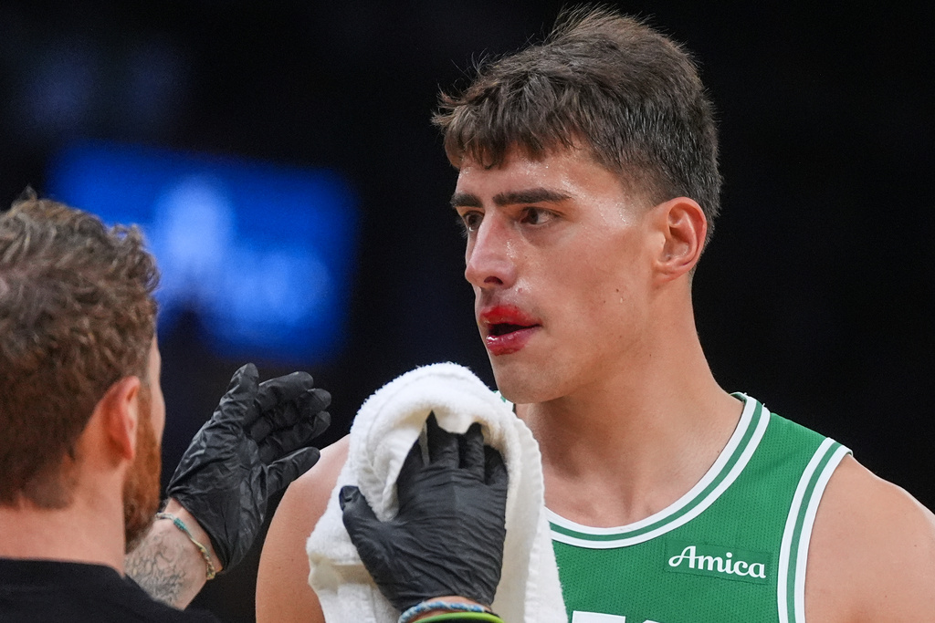 Boston Celtics center Luka Garza has his bloodied face examined during the second half of an NBA basketball game against the Philadelphia 76ers, Wednesday, Oct. 22, 2025, in Boston. (AP Photo/Charles Krupa)