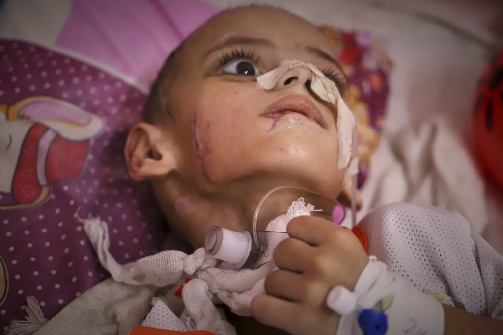 FILE - Three-year-old Amr al-Hams, who has brain damage caused by an Israeli strike on his family's tent in April, lies in a bed at Nasser Hospital in Khan Younis, Gaza Strip, Wednesday, June 25, 2025. (AP Photo/Mariam Dagga, File)