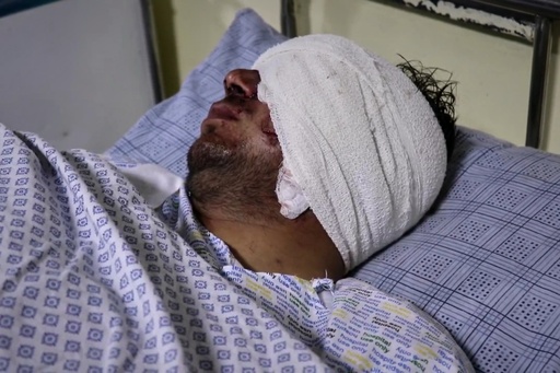 Cricketer Mira Jan lies wounded in a hospital bed after a Pakistani cross-border airstrike that killed several people, including three other local cricketers, at the regional hospital in Afghanistan's eastern Paktika province, Saturday, Oct. 18, 2025. (AP Photo/Shafiqullah Mashaal) Cricketer Mira Jan lies wounded in a hospital bed after a Pakistani cross-border airstrike that killed several people, including three other local cricketers, at the regional hospital in Afghanistan's eastern Paktika province, Saturday, Oct. 18, 2025. (AP Photo/Shafiqullah Mashaal)