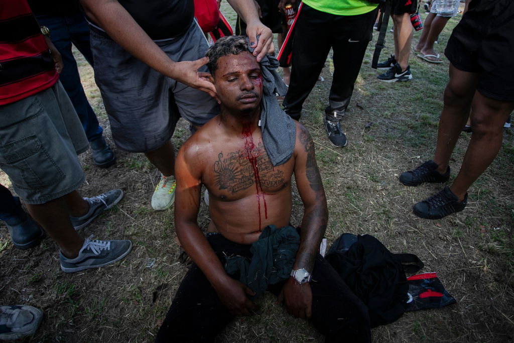 A Flamengo soccer fan sits injured in the head during clashes with police as the team arrives at the airport before flying to Peru for the Copa Libertadores final, in Rio de Janeiro, Wednesday, Nov. 26, 2025. (AP Photo/Bruna Prado)