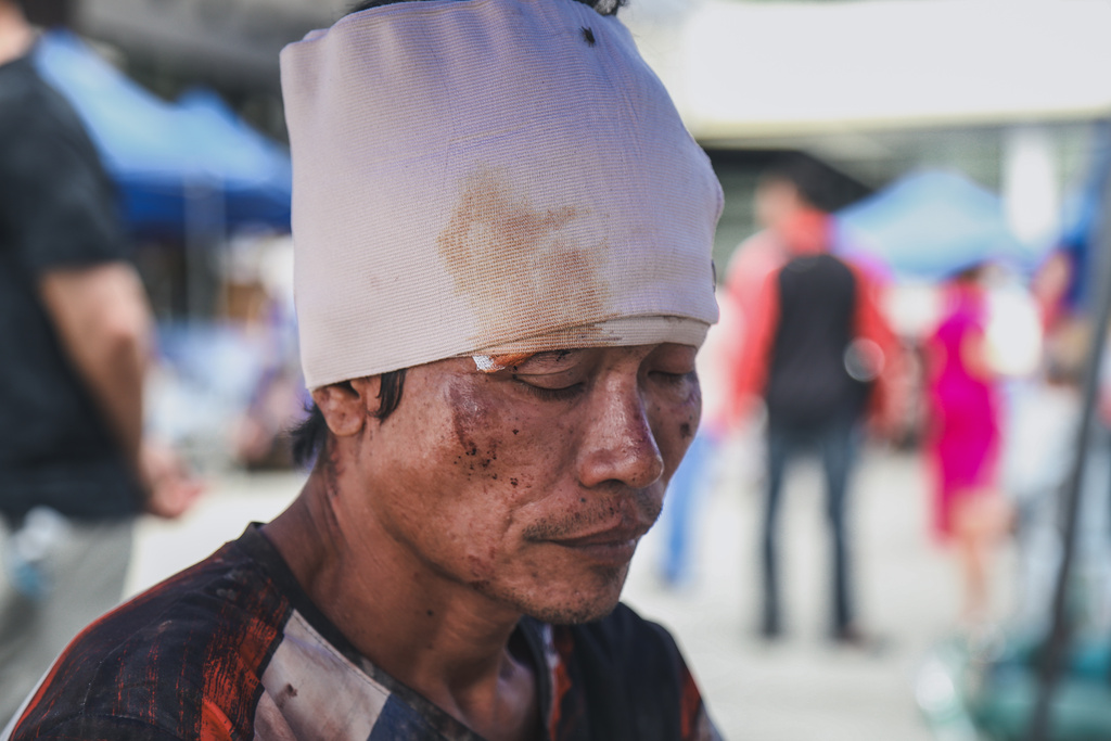 A man injured in an earthquake is seen outside the Cebu Provincial Hospital in Bogo City, Philippines, Wednesday, Oct. 1, 2025. (AP Photo/Jacqueline Hernandez)