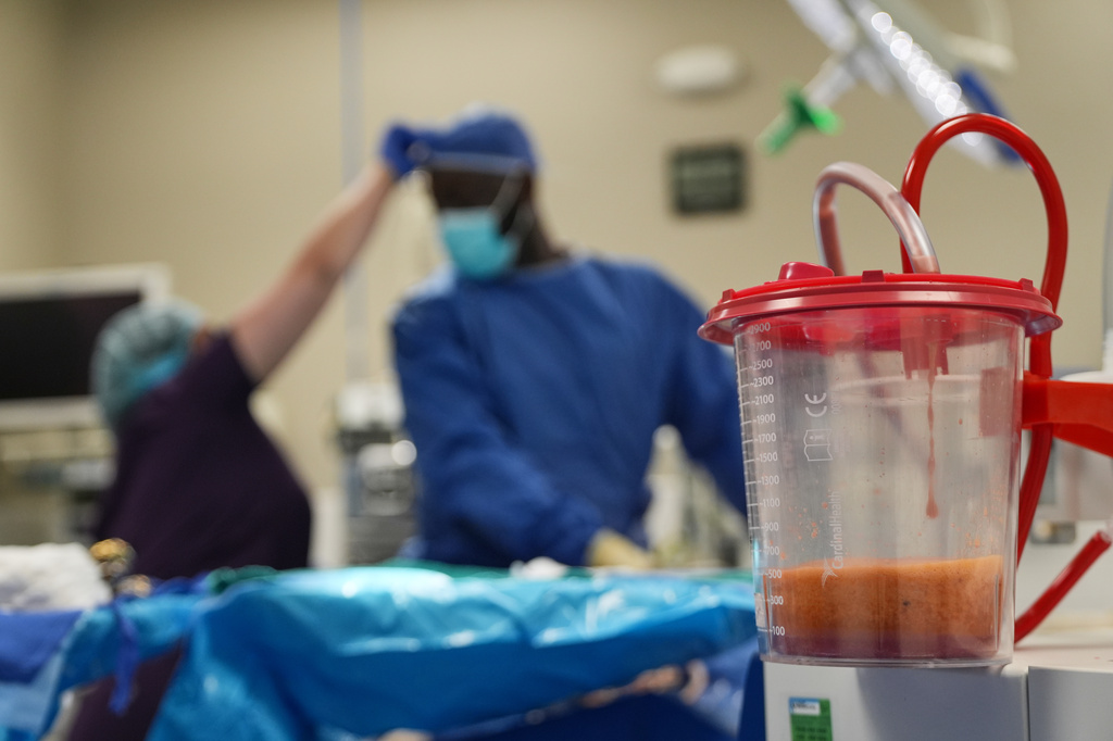 Dr. Michael Obeng, center, performs liposuction at a surgical center in Beverly Hills, Calif., on Thursday, Feb. 5, 2026. (AP Photo/Damian Dovarganes)