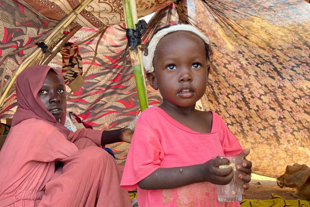 Nabaa Ahmed, 3, an injured Sudanese who fled el-Fasher city, after Sudan's paramilitary forces killed hundreds of people in the western Darfur region, receives medical care at a camp in Tawila, Sudan, Thursday, Oct. 30, 2025. (AP Photo/Mohammed Abaker)