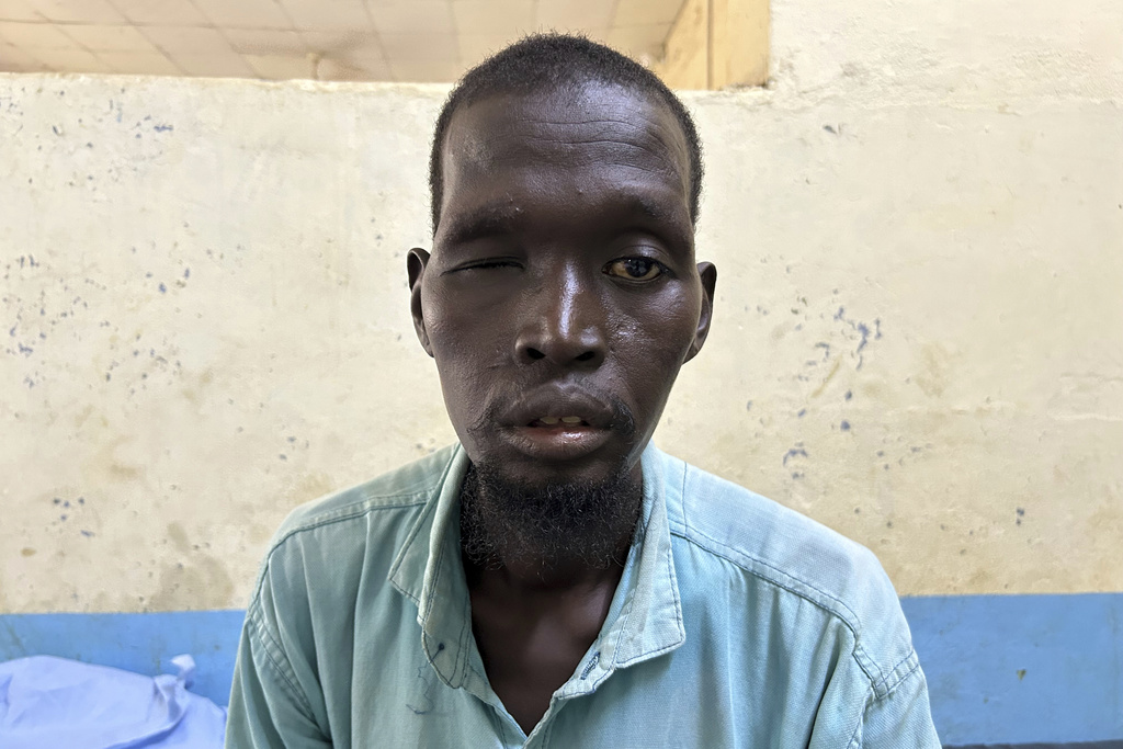 John Chan Majok Deng, 46, who claimed he lost use of his right eye after being beaten with copper wire while imprisoned by The Sudanese Armed Forces, poses for a photo in Renk, South Sudan, Tuesday, Aug 5, 2025. (AP Photo/Adlai Coleman)