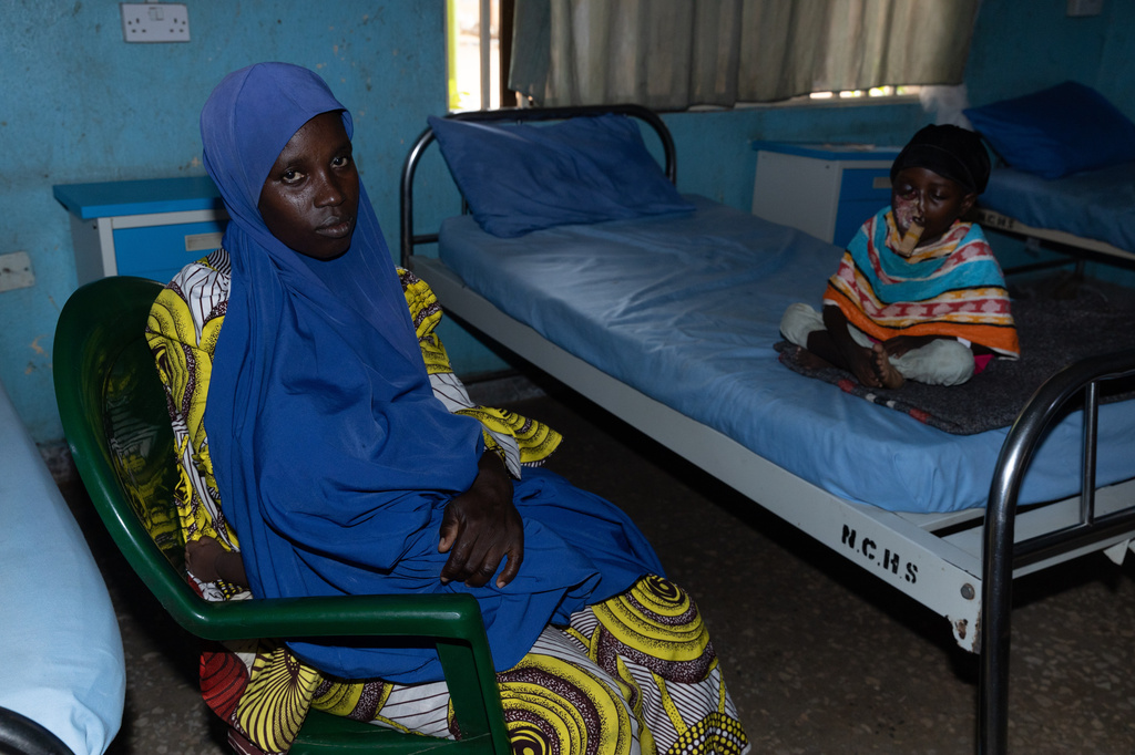Hussaina Alhassan, right, who underwent facial reconstructive surgery to help her recover from noma disease, is photographed at the Noma Children Hospital in Sokoto, northern Nigeria, Thursday, Sept. 3, 2026. (AP Photo/Ifeanyi Emmanuel)