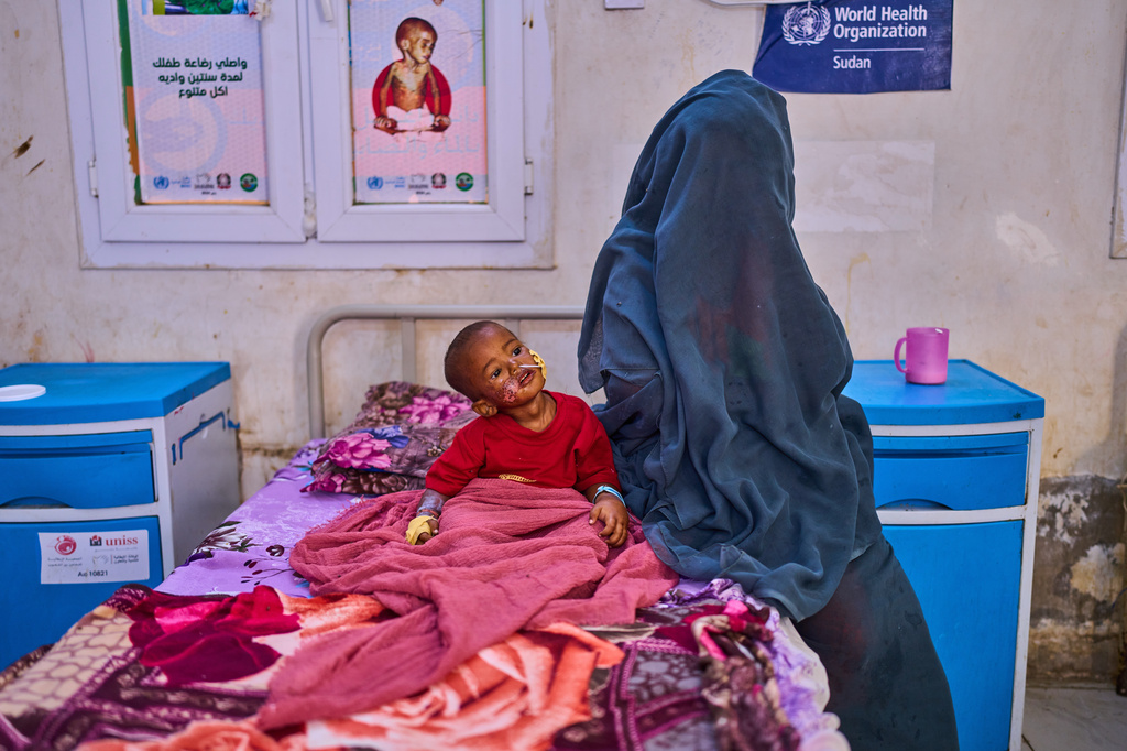 Hashem Abderaman sits in his bed next to his mother while receiving treatment at the paediatric hospital stabilization center in Port Sudan, Sudan, Wednesday, April 15, 2026. (AP Photo/Bernat Armangue)