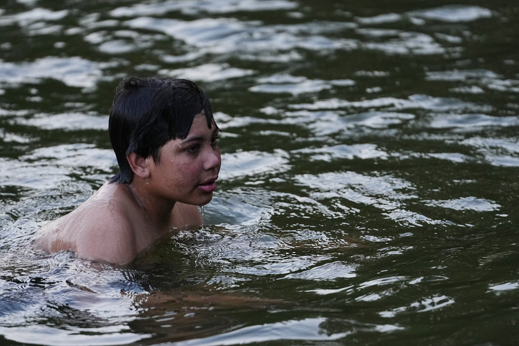 Dylan Aristy Mota, 12, of New York City, who has lupus, swims at the Frost Valley YMCA sleepaway camp in Claryville, N.Y., Wednesday, July 30, 2025. The camp partnered with Children's Hospital at Montefiore so kids with autoimmune diseases could attend for the first time. (AP Photo/Matt Rourke)