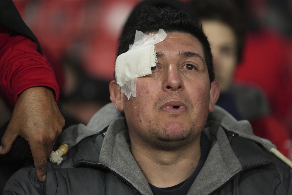 An injured fan of Argentina's Independiente appeals for help after clashes with Universidad de Chile fans during a Copa Sudamericana round of sixteen second leg soccer match at the Libertadores de America stadium in Avellaneda, Argentina, Wednesday, Aug. 20, 2025. (AP Photo/Gustavo Garello)