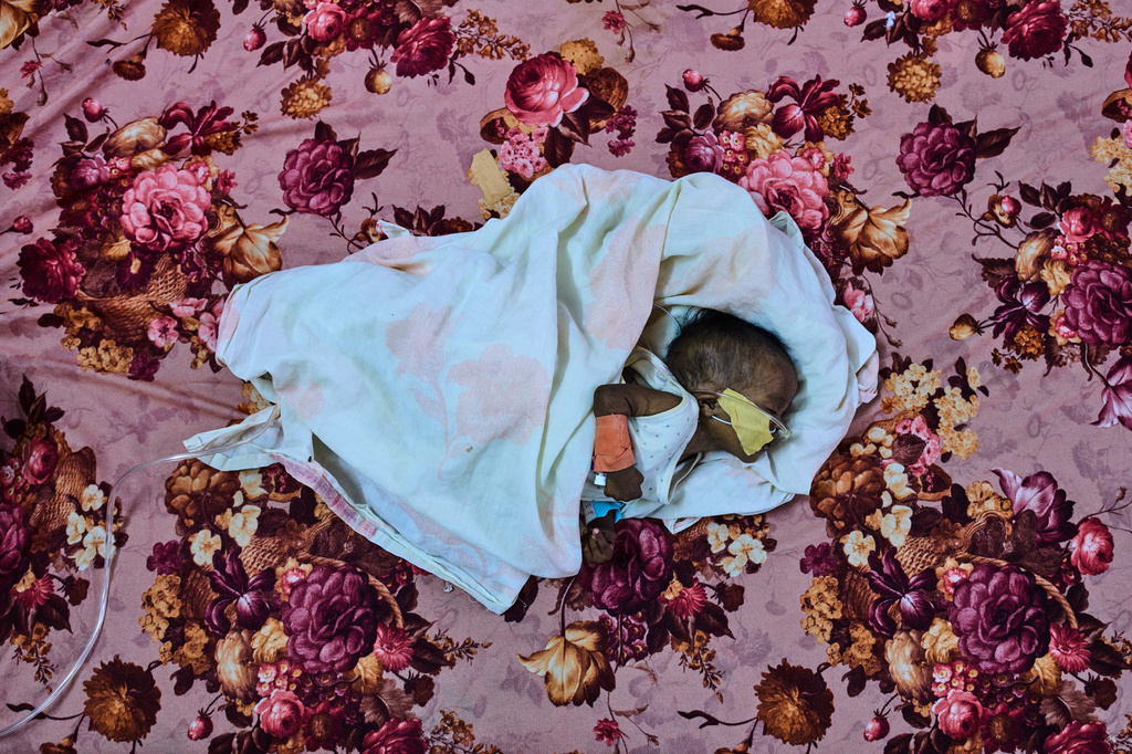 FILE - Patient Saidal Altaher, 2 months, is being treated for malnutrition at the pediatric hospital stabilization center in Port Sudan, Sudan, Wednesday, April 15, 2026. (AP Photo/Bernat Armangue, File)