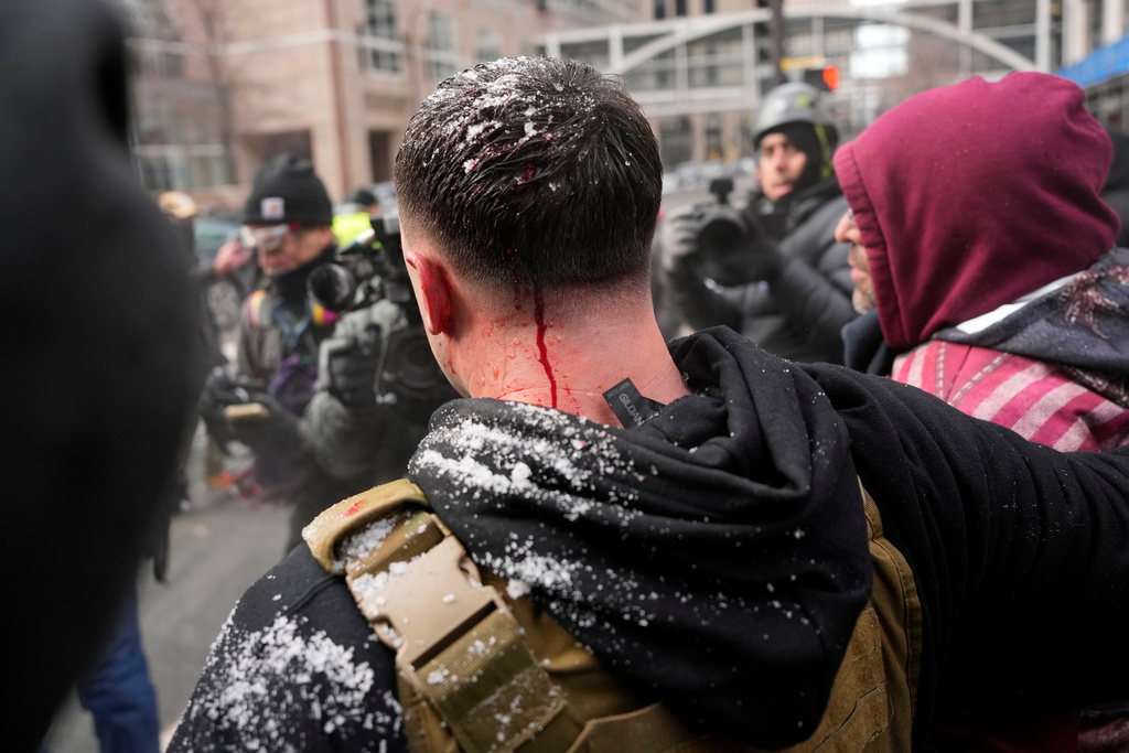 Jake Lang, center, who organized the protest March Against Minnesota Fraud, appears to bleed from the back of his head after clashing with pro-immigration counterprotesters near Minneapolis City Hall, Saturday, Jan. 17, 2026, in Minneapolis. (AP Photo/Yuki Iwamura)