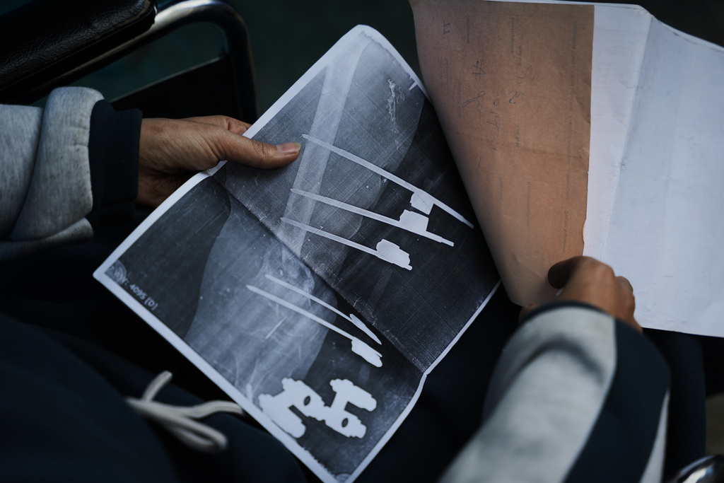 Islam Saleh, who was injured in her left leg in an Israeli strike on a school shelter in Jabalia in 2024, shows her medical reports inside her family's tent in Zawaida, Gaza Strip, Tuesday, Jan. 27, 2026, as she awaits permission to travel outside Gaza for treatment. (AP Photo/Abdel Kareem Hana)