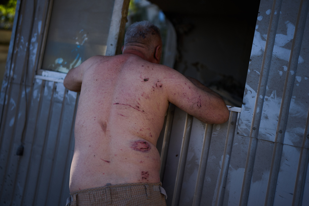 Parking security guard Oleksandr Hnatiuk, 57, smokes a cigarette in front of the booth where he was injured during an overnight Russian missile and drone attack, in Kyiv, Ukraine, Thursday, Aug. 20, 2026. (AP Photo/Francisco Seco)