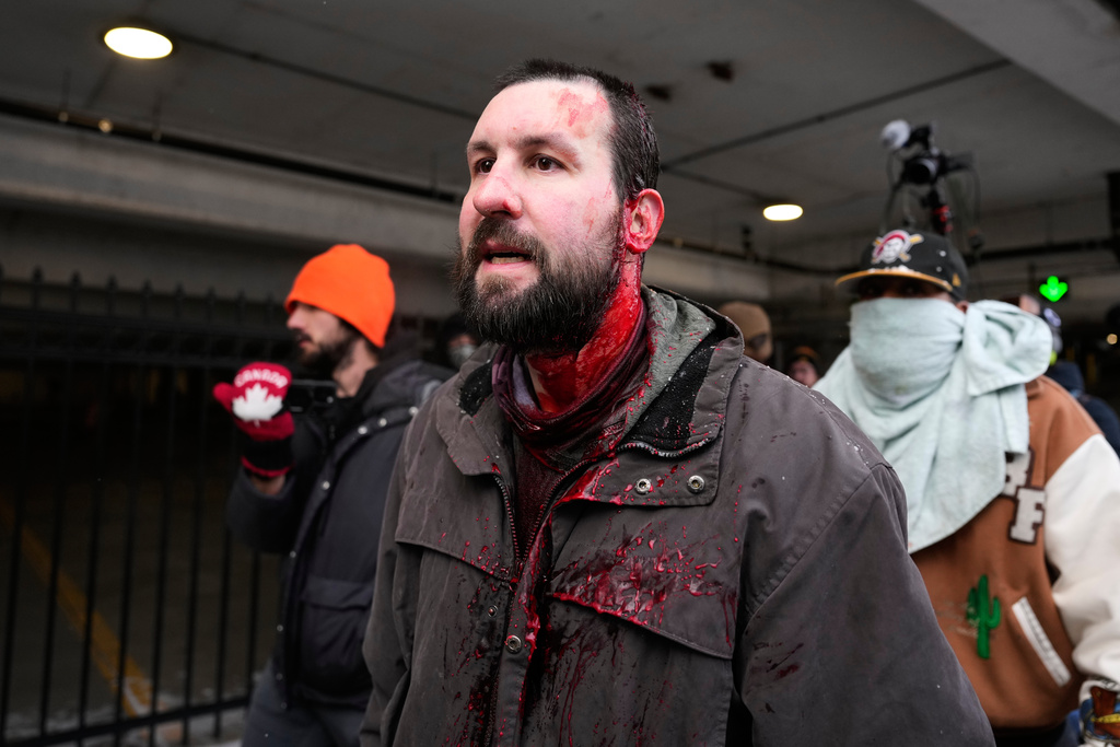 A Jake Lang supporter bleeds from his head as he is chased away by pro-immigration protesters Saturday, Jan. 17, 2026, in Minneapolis. (AP Photo/Yuki Iwamura)