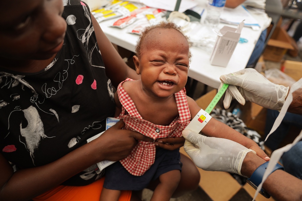 A malnourished child is checked on by a doctor from an traveling pharmacy at a shelter for families displaced by gang violence in Port-au-Prince, Haiti, Tuesday, Oct. 7, 2025. (AP Photo/Patrice Noel)