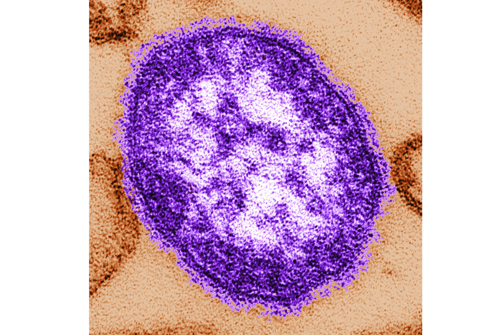 FILE - This undated image made available by the Centers for Disease Control and Prevention on Feb. 4, 2015, shows an electron microscope image of a measles virus particle. (Cynthia Goldsmith/Centers for Disease Control and Prevention, via AP, File)