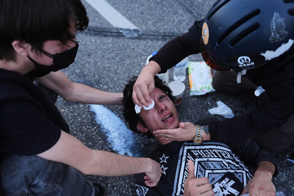 A protester's eyes are washed out after getting tear gassed during a scuffle between federal police at the Metropolitan Detention Center in downtown Los Angeles on Friday, Jan. 30, 2026. (AP Photo/Jae C. Hong)