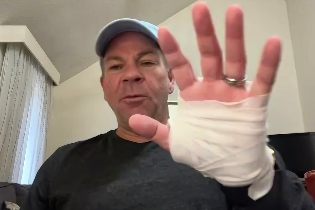 In this image taken from video, Michael Black, a Rhode Island man who helped stop a shooter at a high school hockey game on Monday, holds up his injured hand during an interview with The Associated Press, Thursday, Feb. 19, 2026 in Spartanburg, S.C. (AP Photo)