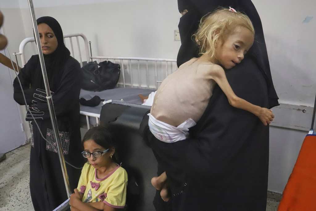 CORRECTS AGE OF SHAMM, WHO HAD NOT YET TURNED 2 - Islam Qudeih holds her severely malnourished daughter, Shamm, who is three weeks shy of her second birthday, to journalists at Nasser Hospital in Khan Younis, southern Gaza Strip, on Aug. 9, 2025. Doctors said Shamm may have a genetic disorder that affects muscle and bone development, but there is no way to test for it in Gaza. (AP Photo/Mariam Dagga)