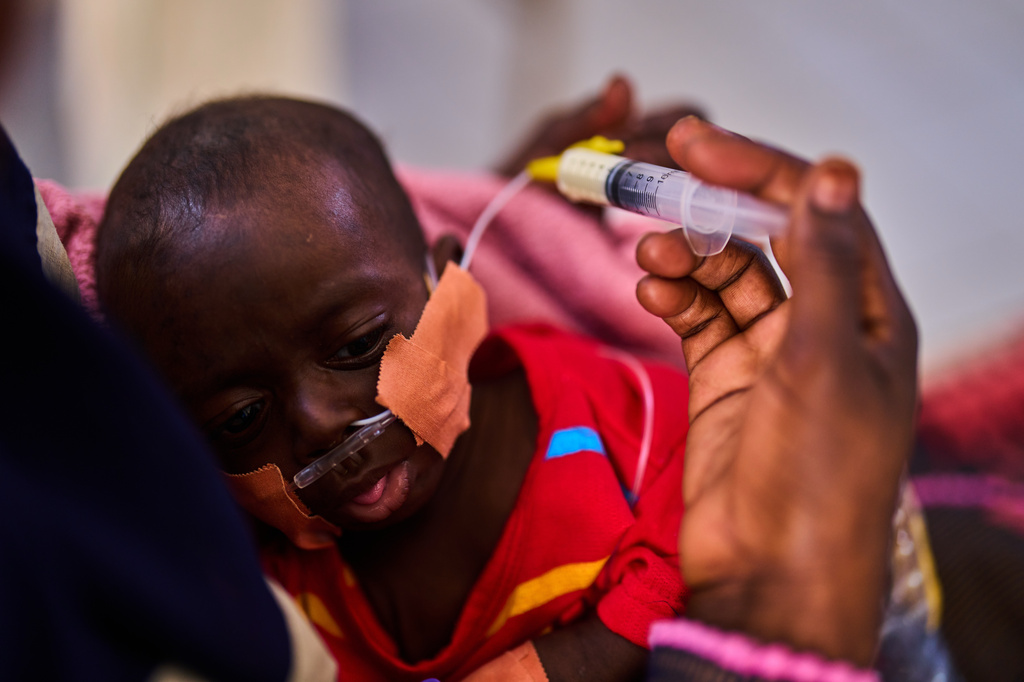 A mother feeds baby formula to her son, who is being treated for malnutrition, at the paediatric hospital stabilization center in Port Sudan, Sudan, Wednesday, April 15, 2026. (AP Photo/Bernat Armangue)