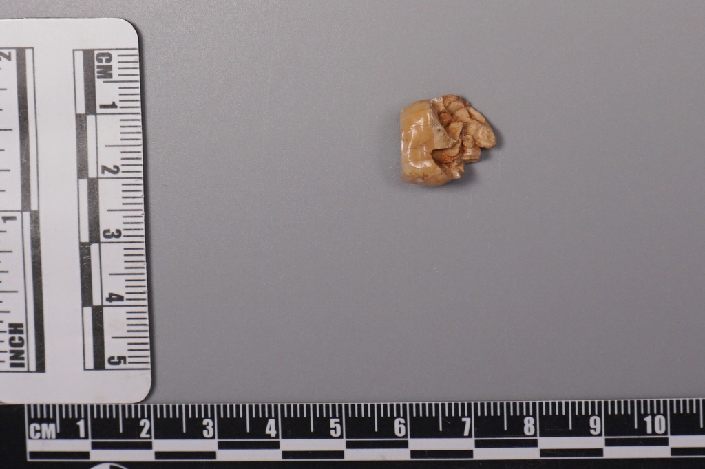 This undated image provided by the Institute of Vertebrate Paleontology and Paleoanthropology, Chinese Academy of Sciences shows an ancient tooth found at the Hexian archaeological site in eastern China. (Kai Zhou/Institute of Vertebrate Paleontology and Paleoanthropology, Chinese Academy of Sciences via AP)
